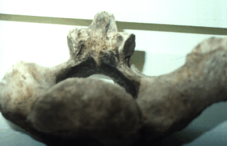 Vrtebra de Megaterio